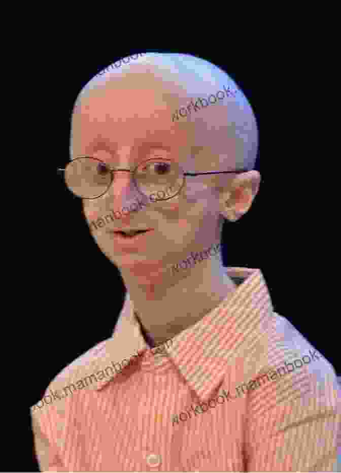 Sam Berns, A Young Man With Progeria, Sitting In A Wheelchair And Holding A Microphone, Speaking To A Large Audience Juno S Place: Where A Little Dog Does Big Things